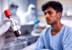 Mpox Alert: Rising Cases in Sindh, A Comprehensive Guide to Symptoms, Spread, and Prevention